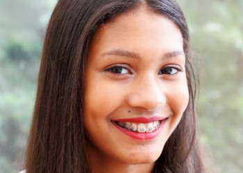 Braces for Teenagers, Vancouver Orthodontist