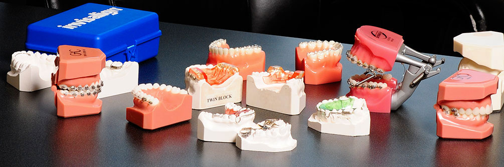 Orthodontic & Braces Options, Vancouver, BC